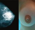 Tysice kobiet oszukanych przez producentw Breastlight