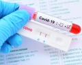 Testowanie pracownikw NHS na Covid-19